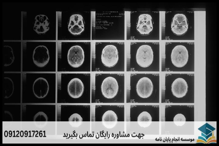 انجام پروپوزال رشته زبان شناسی روانشناختی — تصویر 1